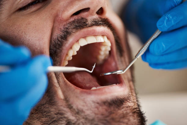Best Emergency Dental Care for Trauma or Injury in Homestead Valley, CA